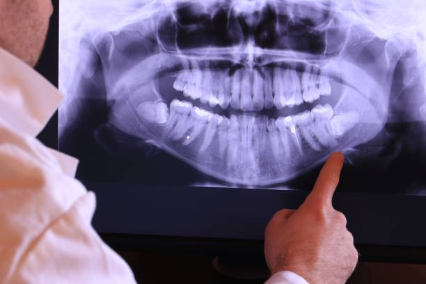 Best Tooth Pain Emergency Relief  in Clute, TX